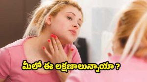 Vitamin C Deficiency: మీలో ఈ లక్షణాలున్నాయా ? అయితే జాగ్రత్త