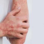 Blood Cancer Symptoms: ఈ లక్షణాలు మీలో ఉన్నాయా ? అస్సలు లైట్ తీసుకోవద్దు, బ్లడ్ క్యాన్సర్ కావొచ్చు