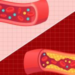 Good Vs Bad Cholesterol: మంచి, చెడు కొలెస్ట్రాల్ మధ్య తేడా ఏంటి ?