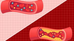 Good Vs Bad Cholesterol: మంచి, చెడు కొలెస్ట్రాల్ మధ్య తేడా ఏంటి ?