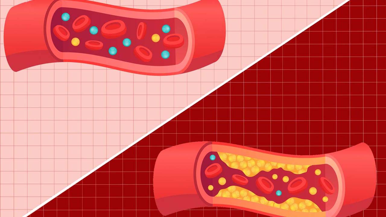 Good Vs Bad Cholesterol: మంచి, చెడు కొలెస్ట్రాల్ మధ్య తేడా ఏంటి ?