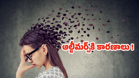 Alzheimers: చిన్న చిన్న విషయాలకే కన్‌ఫ్యూజ్ అవుతున్నారా ? కారణం ఇదే !