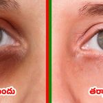 Alum For Dark Circles: పటికతో డార్క్ సర్కిల్స్‌కి చెక్.. ఒక్కసారి వాడితే బోలెడు బెనిఫిట్స్