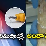 Broken Bone: ఎముక విరిగిందా? ఇక నో టెన్షన్.. జస్ట్ గమ్ పెట్టి అతికించేయడమే!