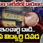Teacher Attack: విద్యార్థి దవడ విరిగేలా కొట్టిన కాలేజ్ సిబ్బంది..