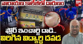 Teacher Attack: విద్యార్థి దవడ విరిగేలా కొట్టిన కాలేజ్ సిబ్బంది..