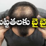 Bald Head: బట్టతల బాబులకు బంగారం లాంటి న్యూస్, ఇలా చేస్తే నేచురల్‌ గానే జుట్టు వచ్చేస్తాదట!