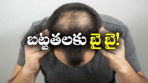 Bald Head: బట్టతల బాబులకు బంగారం లాంటి న్యూస్, ఇలా చేస్తే నేచురల్‌ గానే జుట్టు వచ్చేస్తాదట!