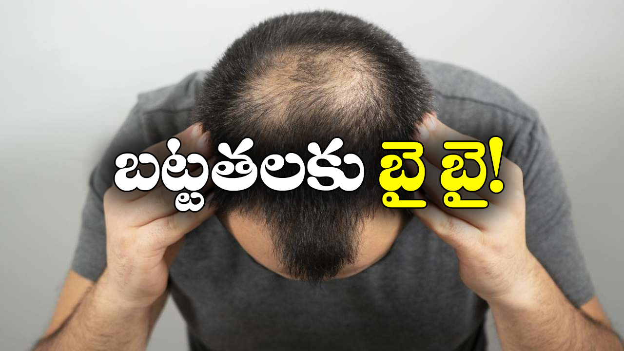 Bald Head: బట్టతల బాబులకు బంగారం లాంటి న్యూస్, ఇలా చేస్తే నేచురల్‌ గానే జుట్టు వచ్చేస్తాదట!