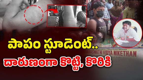 School Teacher: ‘D’ పదం పలకలేదని విద్యార్థిని కొరికిన టీచర్.. రాష్ట్రంలో దారుణ ఘటన