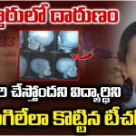 Attack on student: అల్లరి చేస్తోందని.. విద్యార్థిని పుర్రె పగిలేలా కొట్టిన టీచర్