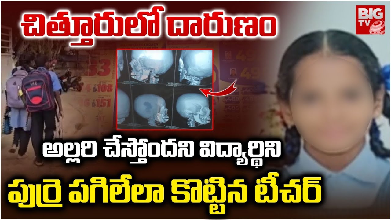 Attack on student: అల్లరి చేస్తోందని.. విద్యార్థిని పుర్రె పగిలేలా కొట్టిన టీచర్