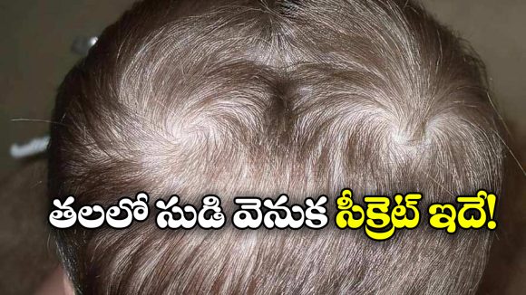 Double Crown Hair: తలపై రెండు సుడులు ఉంటే రెండు పెళ్లిల్లు అవుతాయా?