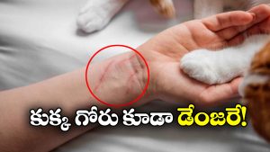 Shocking News: షాకింగ్.. కుక్క గోరు గుచ్చుకుని యువకుడు మృతి!