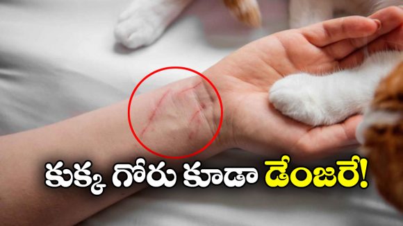 Shocking News: షాకింగ్.. కుక్క గోరు గుచ్చుకుని యువకుడు మృతి!