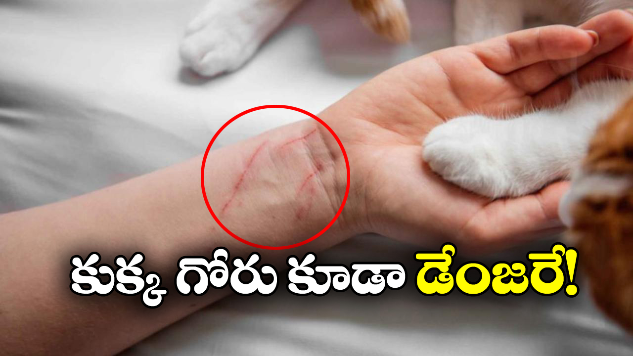 Shocking News: షాకింగ్.. కుక్క గోరు గుచ్చుకుని యువకుడు మృతి!