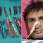 Steel Spoons In Stomach: కడుపులో 29 స్టీల్ స్పూన్లు, 19 టూత్ బ్రష్ లు..అలా ఎలా మింగేశావ్ భయ్యా!