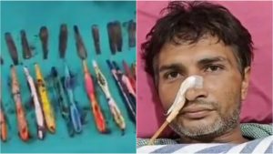 Steel Spoons In Stomach: కడుపులో 29 స్టీల్ స్పూన్లు, 19 టూత్ బ్రష్ లు..అలా ఎలా మింగేశావ్ భయ్యా!