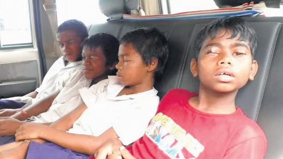 Odisha school: దారుణం.. నిద్రిస్తున్న విద్యార్థుల కళ్ళలో ఫెవిక్విక్  పోసిన తోటి విద్యార్థి.. Odisha school: దారుణం.. నిద్రిస్తున్న విద్యార్థుల కళ్ళలో ఫెవిక్విక్  పోసిన తోటి విద్యార్థి..