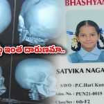 Chittoor: అల్లరి చేస్తోందని విద్యార్థిని పుర్రె పగలకొట్టిన టీచర్..