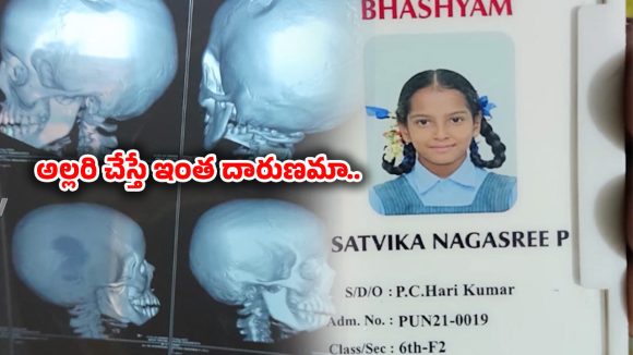 Chittoor: అల్లరి చేస్తోందని విద్యార్థిని పుర్రె పగలకొట్టిన టీచర్..