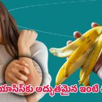 Psoriasis Health Tips: బనానా తొక్కతో సోరియాసిస్ తగ్గుతుందా? నిజం ఏమిటో తెలుసుకోండి