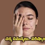 Common Skin Problems: ఎక్కువ మందిలో వచ్చే.. చర్మ సమస్యలు ఏంటో తెలుసా ?