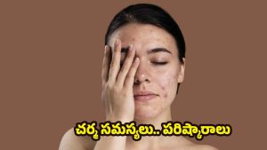 Common Skin Problems: ఎక్కువ మందిలో వచ్చే.. చర్మ సమస్యలు ఏంటో తెలుసా ?