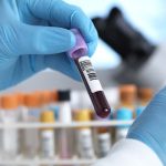 Cancer  Tests: క్యాన్సర్ గుర్తించడానికి.. ఏ టెస్టులు చేస్తారు ?