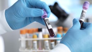 Cancer  Tests: క్యాన్సర్ గుర్తించడానికి.. ఏ టెస్టులు చేస్తారు ?