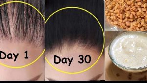 Fenugreek Seeds For Hair: ఏవేవో వాడాల్సిన అవసరమే లేదు, మెంతులు ఇలా వాడితే ఒత్తైన కురులు