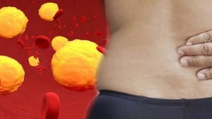 Cholesterol: శరీరంలో కొలెస్ట్రాల్ పెరిగినప్పుడు.. ఎలాంటి లక్షణాలు కనిపిస్తాయ్ !