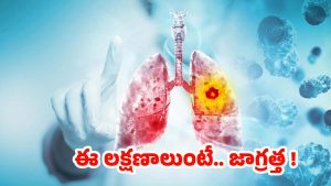 Lung Cancer: ఊపిరితిత్తుల క్యాన్సర్.. చాలా మంది నిర్లక్ష్యం చేసే లక్షణాలివే !