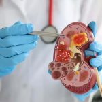 Kidneys: మీలో ఈ అలవాట్లున్నాయా ? వెంటనే మానేయండి !
