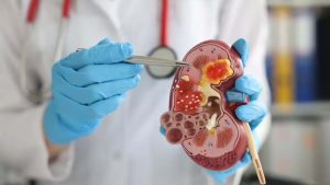 Kidneys: మీలో ఈ అలవాట్లున్నాయా ? వెంటనే మానేయండి !