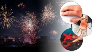 Diwali First-Aid Guide: పండగ సమయంలో కాలిన గాయాలా ?  ఇలా చిట్కాలు పాటించండి