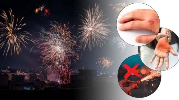 Diwali First-Aid Guide: పండగ సమయంలో కాలిన గాయాలా ?  ఇలా చిట్కాలు పాటించండి