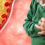Lower Cholesterol: మందులు లేకుండా కొలెస్ట్రాల్ తగ్గించే.. సహజ మార్గాలు ఏంటో తెలుసా ?