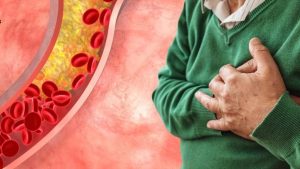 Lower Cholesterol: మందులు లేకుండా కొలెస్ట్రాల్ తగ్గించే.. సహజ మార్గాలు ఏంటో తెలుసా ?