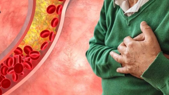 Lower Cholesterol: మందులు లేకుండా కొలెస్ట్రాల్ తగ్గించే.. సహజ మార్గాలు ఏంటో తెలుసా ? Lower Cholesterol: మందులు లేకుండా కొలెస్ట్రాల్ తగ్గించే.. సహజ మార్గాలు ఏంటో తెలుసా ?