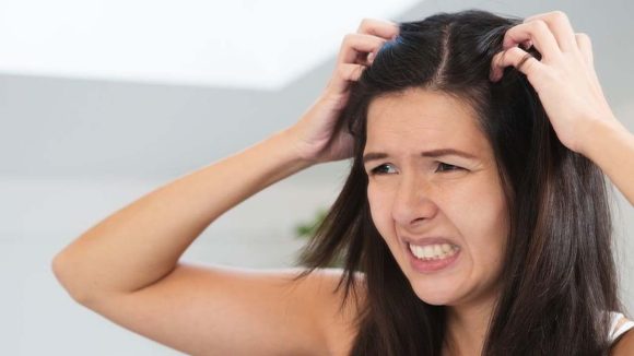 Dandruff: చుండ్రు ఎంతకీ తగ్గడం లేదా ? ఒక్కసారి ఈ టిప్స్ ట్రై చేసి చూడండి