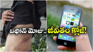 iPhone Kidney: కిడ్నీ అమ్మేసి మరీ ఐఫోన్ కొన్నాడు.. ఇప్పుడు ఆస్పత్రిలో దయనీయ స్థితిలో..
