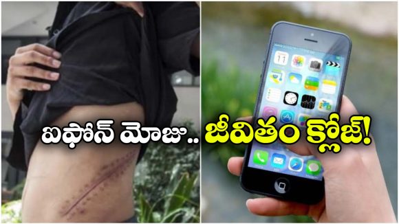 iPhone Kidney: కిడ్నీ అమ్మేసి మరీ ఐఫోన్ కొన్నాడు.. ఇప్పుడు ఆస్పత్రిలో దయనీయ స్థితిలో..