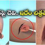 Ear Reconstruction: చెవి తెగి పడినా.. మీ చర్మంపైనే కొత్త చెవిని పుట్టించవచ్చు, ఇదిగో ఇలా!