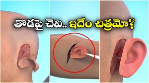 Ear Reconstruction: చెవి తెగి పడినా.. మీ చర్మంపైనే కొత్త చెవిని పుట్టించవచ్చు, ఇదిగో ఇలా!