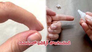 Feviquik tips: చేతికి ఫెవిక్విక్ అంటుకుందా.. ఒక్కసారి ఈ ట్రిక్ ప్రయత్నించండి..