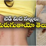 Bed Bugs: బెడ్ మీద నల్లులు నిద్రలేకుండా చేస్తున్నాయా? ఇలా చేస్తే మళ్లీ రావు!