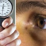 High Blood Pressure: కంటి సమస్యలా ? మీకు.. హైబీపీ కావొచ్చు !