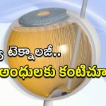 Prima: వైద్య చరిత్రలో అద్భుతం.. ‘ప్రిమా’తో అంధత్వానికి శాశ్వత చెక్!