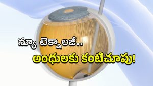 Prima: వైద్య చరిత్రలో అద్భుతం.. ‘ప్రిమా’తో అంధత్వానికి చెక్!